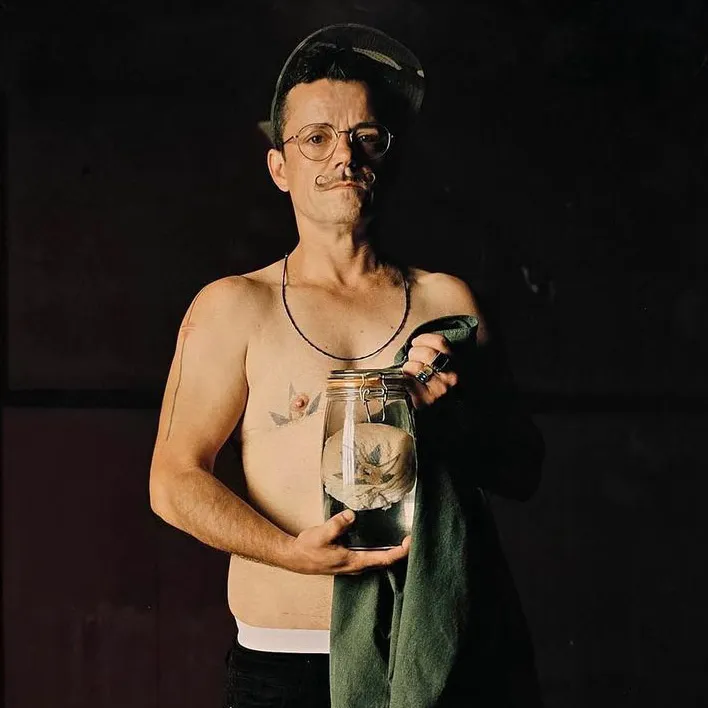 A man looking into the camera holding a jar containging his breast tissue